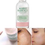 محلول ضدجوش ماریو بدسکو MARIO BADESCU DRYING LOTION