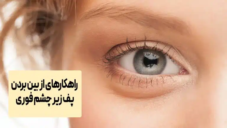 از بین بردن پف زیر چشم فوری