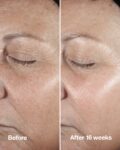 سرم ضد چروک اسمارت کلینیک Clinique