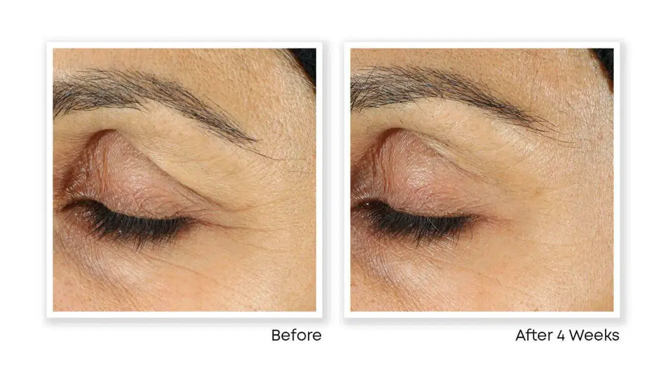 کرم دور چشم رتینول راک RoC Retinol