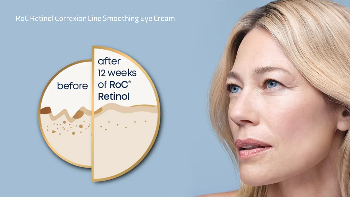 کرم دور چشم رتینول راک RoC Retinol