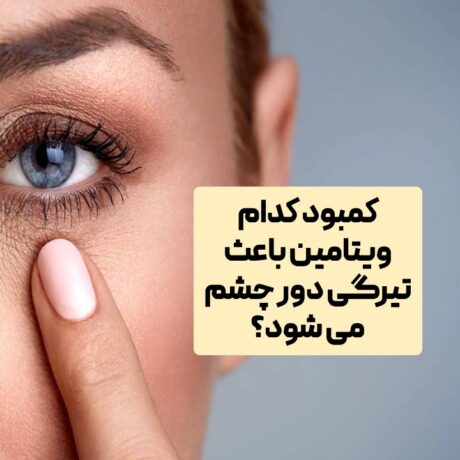 کمبود کدام ویتامین باعث تیرگی دور چشم می شود