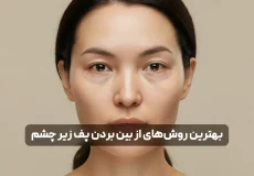 بهترین روش های از بین بردن پف زیر چشم فوری