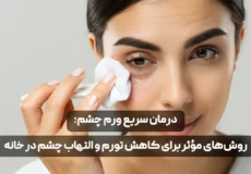 سریع ورم چشم روش های مؤثر برای کاهش تورم و التهاب چشم در خانه - فروشگاه موراشین